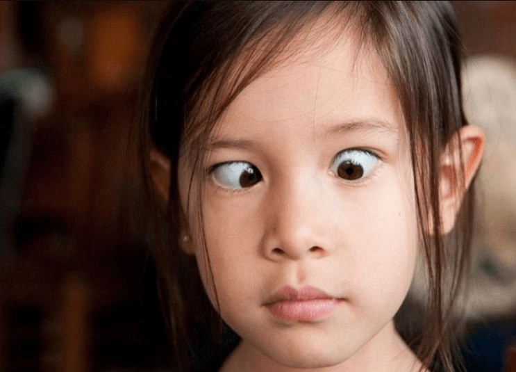 các bệnh về mắt ở trẻ em