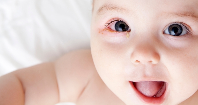 trẻ sơ sinh bị gỉ mắt